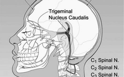 Is there a connection between neck pain and headaches?