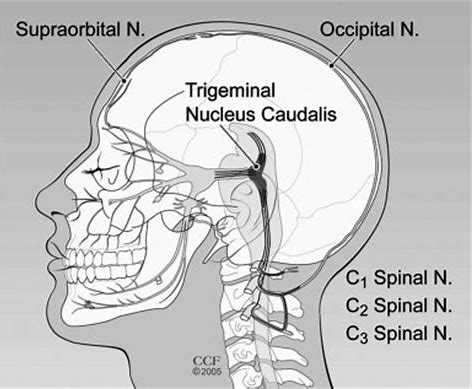 Is there a connection between neck pain and headaches?